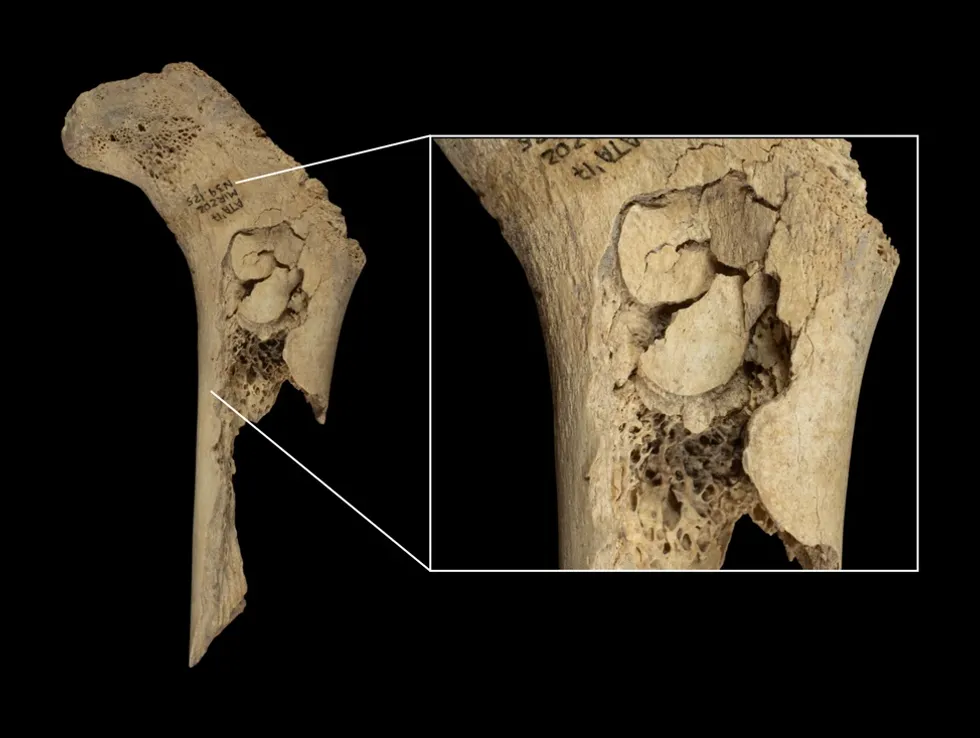 A bone found