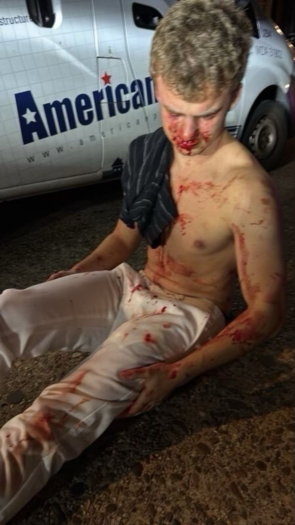 A young man bleeding on the floor