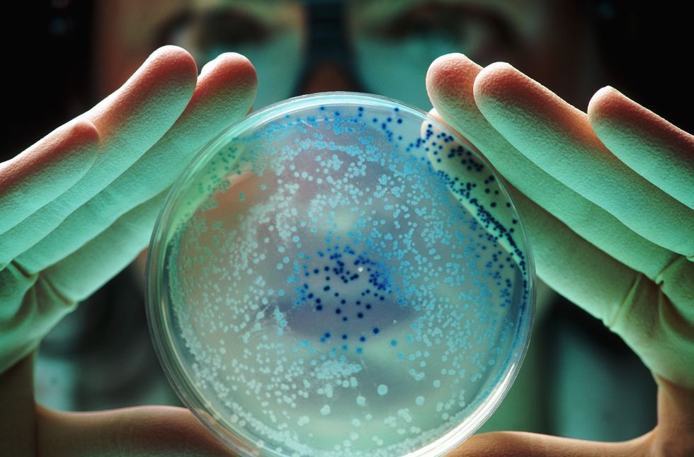 bacteria in petri dish
