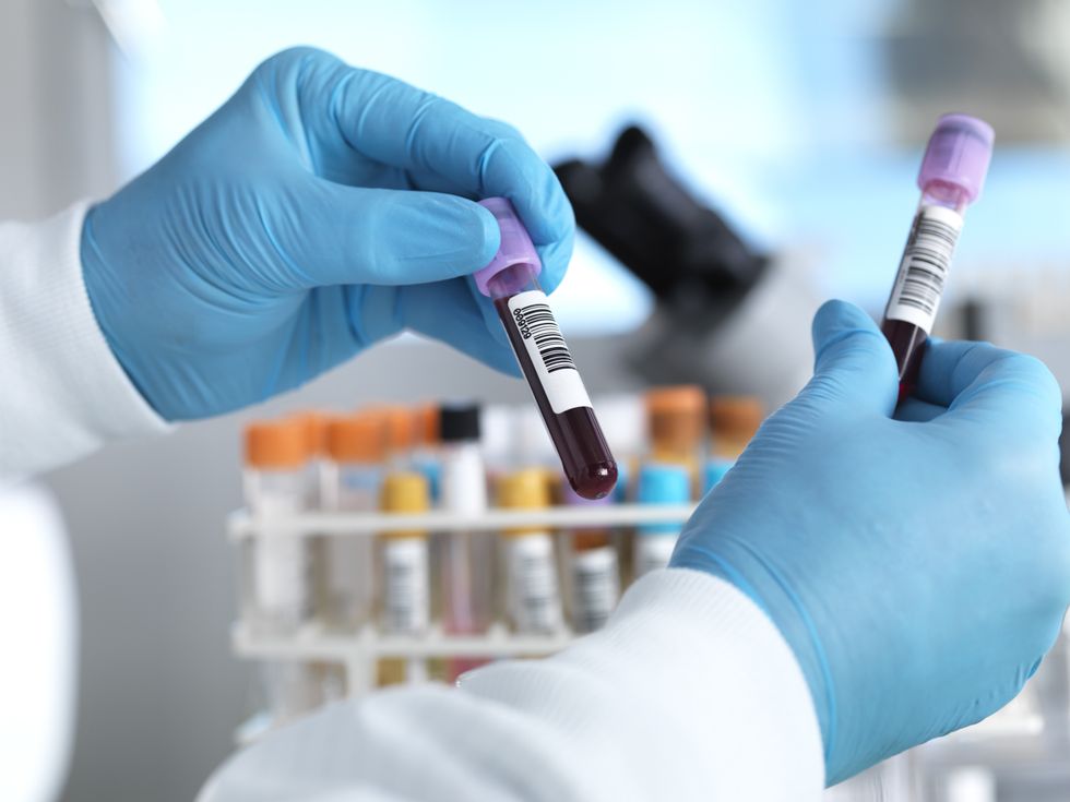 BLOOD VIAL