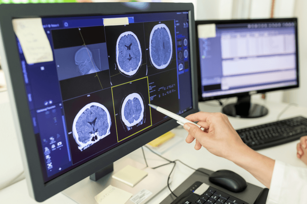 Brain scans