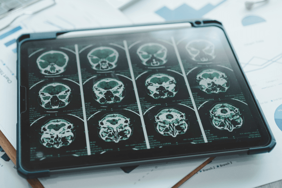 Brain scans