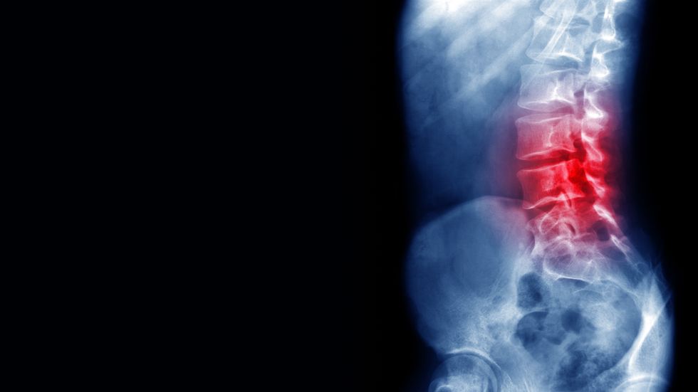 Man with back pain