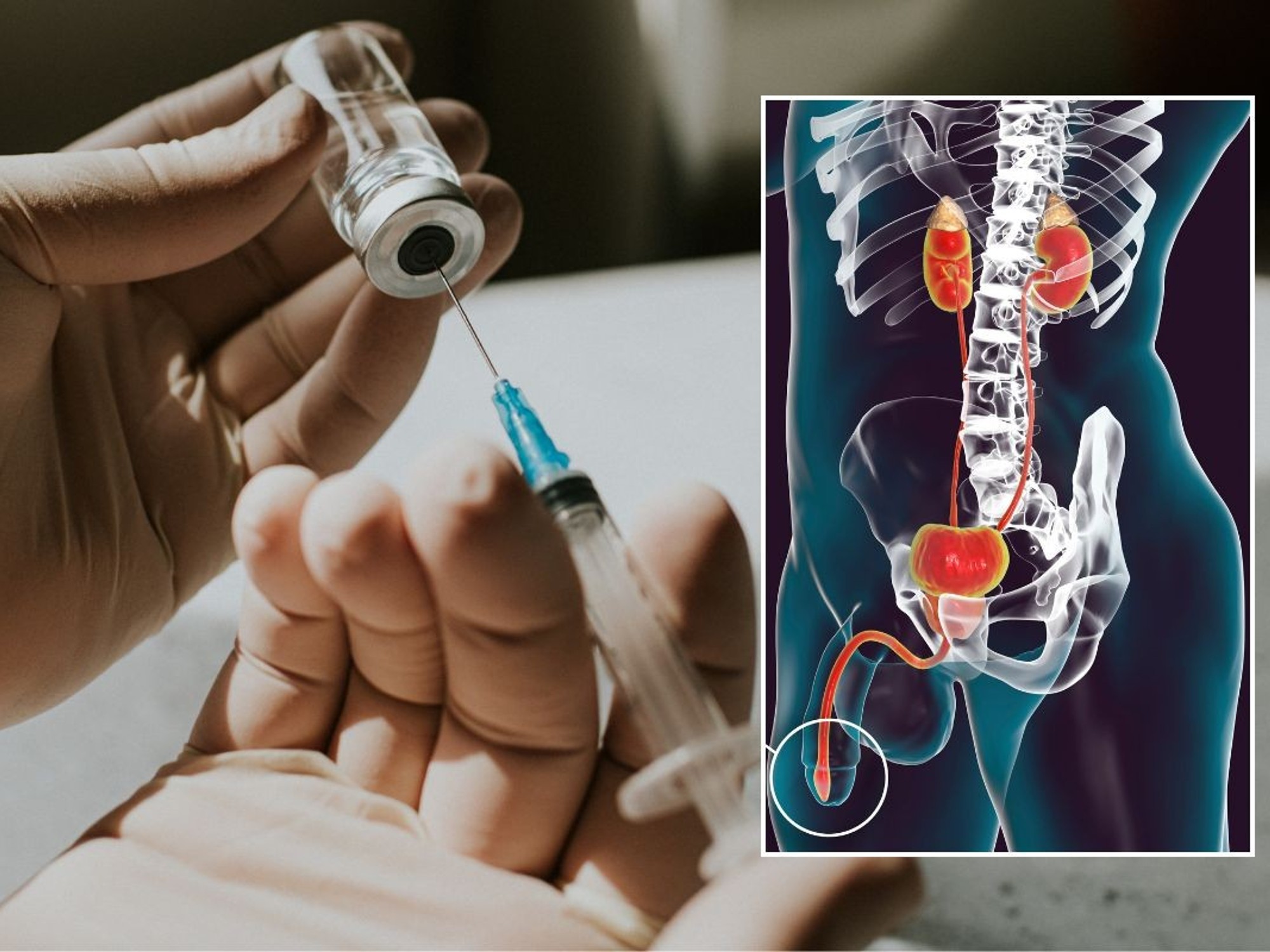 VACCINE AND GONORRHOEA COMPOSITE
